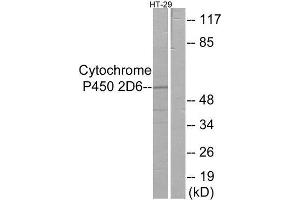 Western Blotting (WB) image for anti-Cytochrome P450, Family 2, Subfamily D, Polypeptide 6 (CYP2D6) (Internal Region) antibody (ABIN1850356) (CYP2D6 anticorps  (Internal Region))