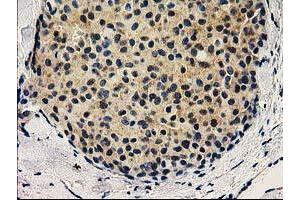 Image no. 2 for anti-V-Set and Immunoglobulin Domain Containing 2 (VSIG2) antibody (ABIN1501737)