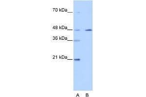 WB Suggested Anti-NR2F2 Antibody Titration: 0. (NR2F2 anticorps  (N-Term))