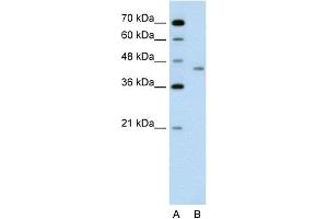 WB Suggested Anti-LRP2BP Antibody Titration:  0. (LRP2BP anticorps  (Middle Region))