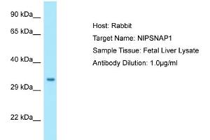 Western Blotting (WB) image for anti-4-Nitrophenylphosphatase Domain and Non-Neuronal SNAP25-Like Protein Homolog 1 (NIPSNAP1) (C-Term) antibody (ABIN2790155) (NIPSNAP1 anticorps  (C-Term))