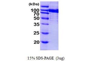 SDS-PAGE (SDS) image for Aconitase 1 (ACO1) (AA 1-889) protein (His tag) (ABIN7279292)