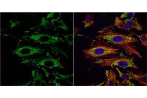 ICC/IF Image UAP1 antibody [N1C3] detects UAP1 protein at cytoplasm by immunofluorescent analysis. (UAP1 anticorps)