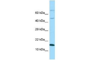 Western Blotting (WB) image for anti-GABA(A) Receptor-Associated Protein Like 1 (GABARAPL1) (Middle Region) antibody (ABIN2774240) (GABARAPL1 anticorps  (Middle Region))