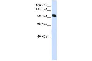 Alpha Actinin 2 antibody used at 1 ug/ml to detect target protein. (ACTN2 anticorps  (N-Term))