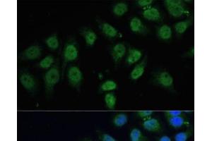 Immunofluorescence analysis of HeLa cells using CPS1 Polyclonal Antibody at dilution of 1:100 (40x lens). (CPS1 anticorps)