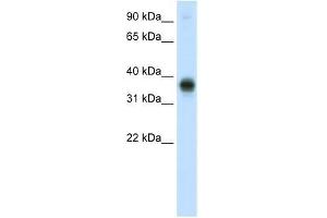 E2F3 antibody used at 0. (E2F3 anticorps  (C-Term))