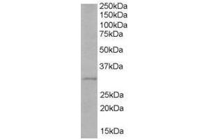 Image no. 1 for anti-Toll-Interleukin 1 Receptor (TIR) Domain Containing Adaptor Protein (TIRAP) (C-Term) antibody (ABIN374117)