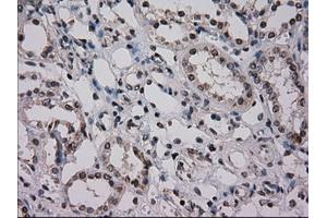 Immunohistochemical staining of paraffin-embedded Kidney tissue using anti-NRBP1mouse monoclonal antibody. (NRBP1 anticorps)