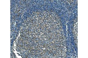 anti-RAB13, Member RAS Oncogene Family (RAB13) (AA 21-200) antibody