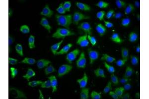 Immunofluorescence staining of A549 cells with ABIN7173187 at 1:100, counter-stained with DAPI.