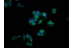Immunofluorescence staining of HepG2 cells with ABIN7154328 at 1:100, counter-stained with DAPI.