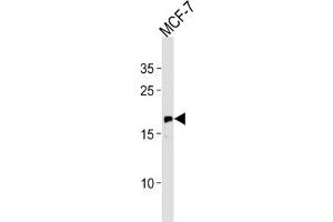 Western Blotting (WB) image for anti-GTPase NRas (NRAS) antibody (ABIN3003468) (GTPase NRas anticorps)