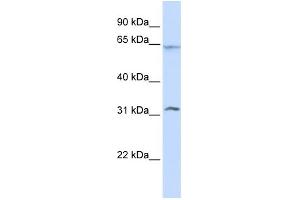 WB Suggested Anti-METT10D Antibody Titration:  0. (METTL16 anticorps  (N-Term))