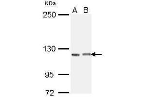 WB Image Sample (30 ug of whole cell lysate) A: H1299 B: Raji 5% SDS PAGE antibody diluted at 1:1000 (IGSF3 anticorps)