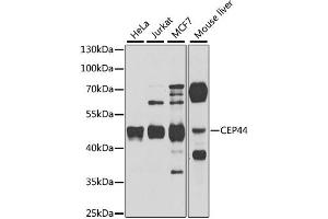 Western blot analysis of extracts of various cell lines, using CEP44 antibody. (CEP44 anticorps)