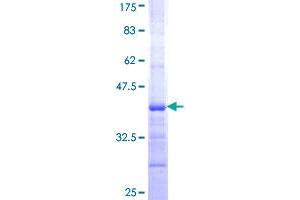 Image no. 1 for NAD Synthetase 1 (NADSYN1) (AA 609-706) protein (GST tag) (ABIN1311926)