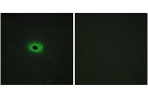 Immunofluorescence analysis of HeLa cells, using TNF12 Antibody. (TWEAK anticorps  (AA 41-90))