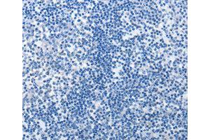 Immunohistochemistry (IHC) image for anti-MutS Homolog 6 (E. Coli) (MSH6) antibody (ABIN1873754) (MSH6 anticorps)