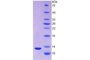 SDS-PAGE of Protein Standard from the Kit (Highly purified E. (TXN Kit ELISA)