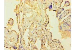 Immunohistochemistry of paraffin-embedded human placenta tissue using ABIN7172759 at dilution of 1:100 (TEAD4 anticorps  (AA 74-434))