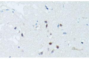 Immunohistochemistry of paraffin-embedded Human brain using MEF2C Polyclonal Antibody at dilution of 1:100 (40x lens).