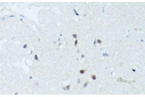 Immunohistochemistry of paraffin-embedded Human brain using MEF2C Polyclonal Antibody at dilution of 1:100 (40x lens). (MEF2C anticorps)