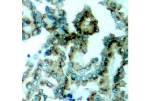 Immunohistochemistry (IHC) image for anti-Protein Kinase C, beta (PRKCB) (pThr641) antibody (ABIN1870521)