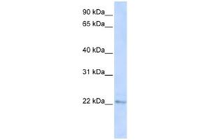 WB Suggested Anti-C6orf64 Antibody Titration:  0. (SAYSD1 anticorps  (C-Term))