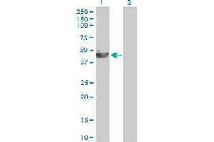 Western Blot analysis of PELO expression in transfected 293T cell line by PELO monoclonal antibody (M03), clone 2C2.