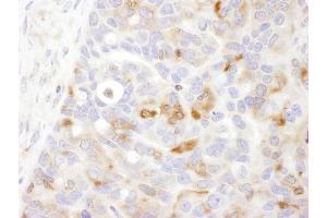 Immunohistochemistry (IHC) image for anti-Bridging Integrator 1 (BIN1) (AA 543-593) antibody (ABIN7454858) (BIN1 anticorps  (AA 543-593))