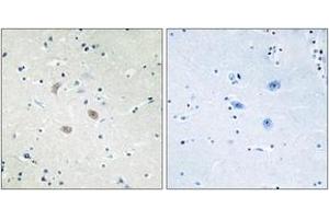 Immunohistochemistry (IHC) image for anti-V-Akt Murine Thymoma Viral Oncogene Homolog 2 (AKT2) (AA 432-481) antibody (ABIN2888944) (AKT2 anticorps  (AA 432-481))