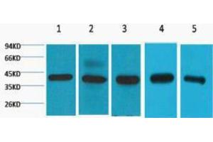 Western Blotting (WB) image for anti-Eukaryotic Translation Initiation Factor 4A1 (EIF4A1) antibody (ABIN3181206)
