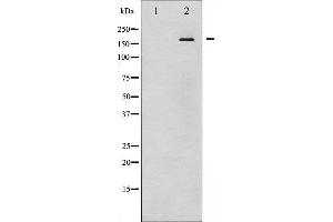 Western blot analysis of EGFR phosphorylation expression in EGF treated HuvEc whole cell lysates,The lane on the left is treated with the antigen-specific peptide.