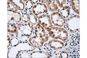 Immunohistochemistry (IHC) image for anti-Bruton Agammaglobulinemia tyrosine Kinase (BTK) antibody (ABIN1496972) (BTK anticorps)