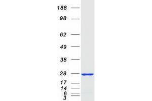 Validation with Western Blot