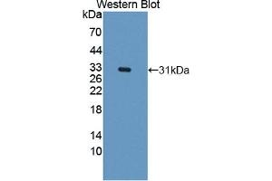 Detection of Recombinant CARD9, Human using Polyclonal Antibody to Caspase Recruitment Domain Family, Member 9 (CARD9)
