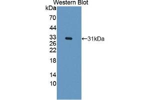 Detection of Recombinant CARD9, Human using Polyclonal Antibody to Caspase Recruitment Domain Family, Member 9 (CARD9) (CARD9 anticorps  (AA 26-283))