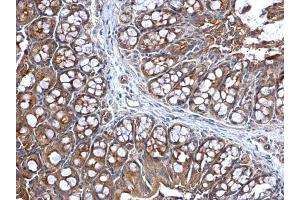 IHC-P Image Lysyl-tRNA synthetase antibody detects Lysyl-tRNA synthetase protein at cytosol on mouse colon by immunohistochemical analysis.