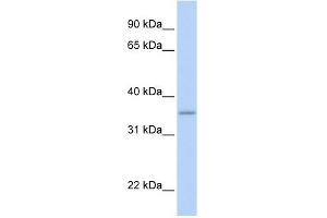 GRHPR antibody used at 1 ug/ml to detect target protein. (GRHPR anticorps  (N-Term))