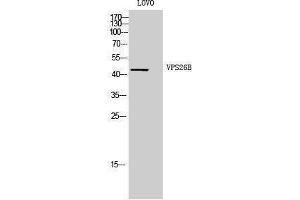 Western Blotting (WB) image for anti-Vacuolar Protein Sorting 26 Homolog B (VPS26B) (Internal Region) antibody (ABIN3187482) (VPS26B anticorps  (Internal Region))