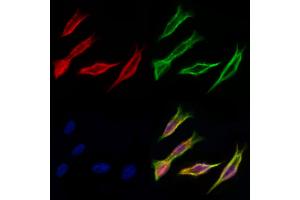 ABIN6259797 and ABIN6277038 staining Hela cells by IF/ICC.