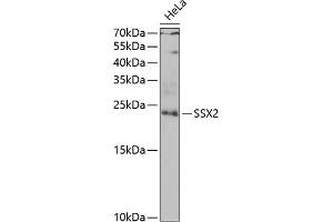 Western blot analysis of extracts of HeLa cells, using SSX2 antibody (ABIN6128794, ABIN6148505, ABIN6148507 and ABIN6222753) at 1:1000 dilution. (SSX2 anticorps  (AA 1-188))
