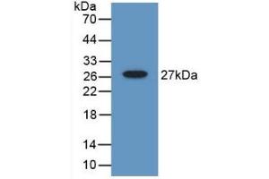 Detection of Recombinant Gelsolin, Mouse using Polyclonal Antibody to Gelsolin (GSN)