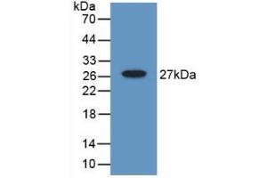 Detection of Recombinant Gelsolin, Mouse using Polyclonal Antibody to Gelsolin (GSN) (Gelsolin anticorps  (AA 432-625))