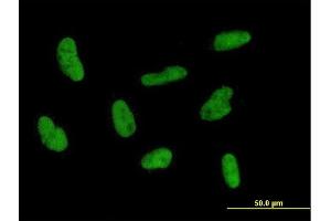 Immunofluorescence of purified MaxPab antibody to GTF2H2 on HepG2 cell.