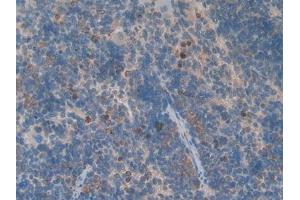 DAB staining on IHC-P; Samples: Rat Spleen Tissue (GDF3 anticorps  (AA 253-366))
