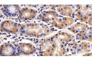 Detection of CNN1 in Human Stomach Tissue using Polyclonal Antibody to Calponin 1, Basic (CNN1) (CNN1 anticorps  (AA 1-268))