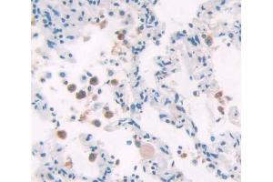 Used in DAB staining on fromalin fixed paraffin- embedded lung tissue (POLD1 anticorps  (AA 41-254))