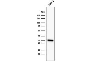 ABIN6383839 to BCL2 was successfully used to stain an approx. (Recombinant Bcl-2 anticorps)